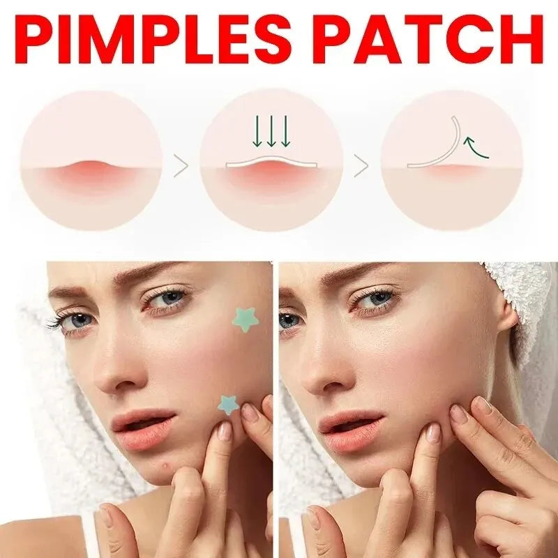 Acne Pimple Repair Patch